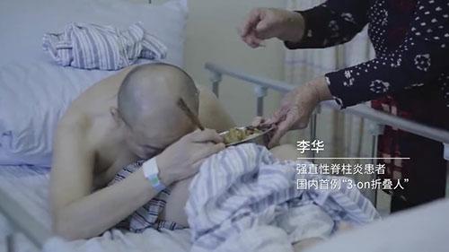 身體被敲斷4次的折疊人出院，打開折疊人生(圖2)