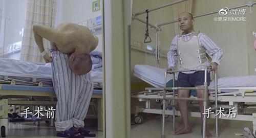 身體被敲斷4次的折疊人出院，打開折疊人生(圖15)
